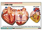Рельефная таблица "Строение сердца" (формат А1) Рельефная таблица "Строение сердца" (формат А1)